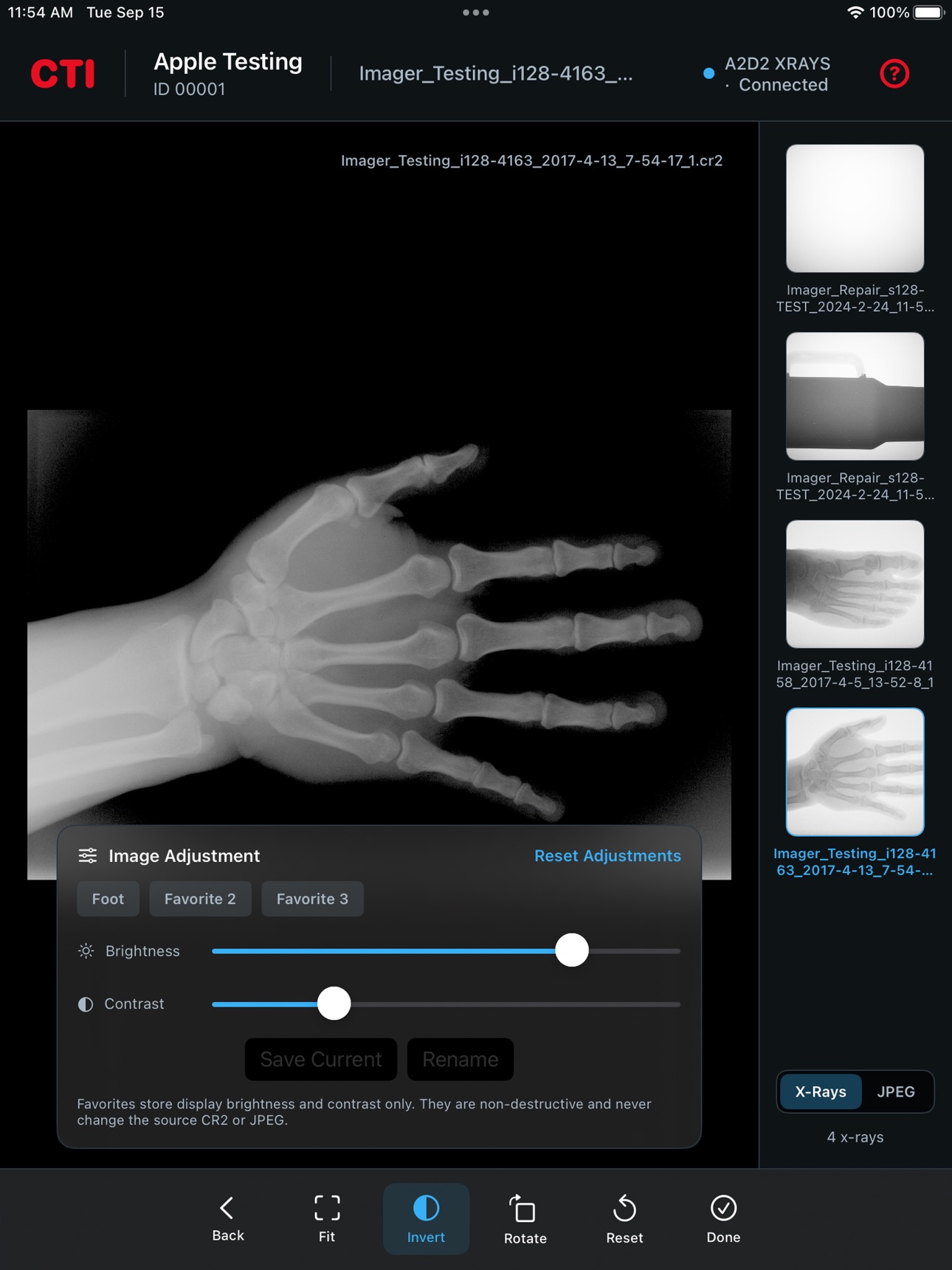 Screenshot 1 of CTI A2D2 Remote X-Ray Viewer