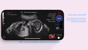 ScanBaby learn baby ultrasound screenshot