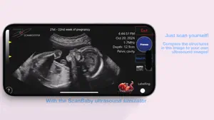 ScanBaby learn baby ultrasound screenshot 3