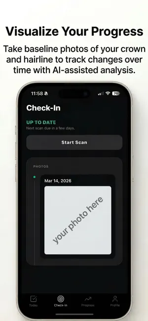 Baldwin – Hair Loss+Growth AI screenshot 2