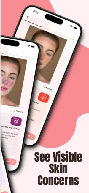 SkinView screenshot 2