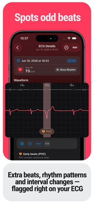 ECG Tracker+ EKG Reader HRV Screenshot 2 of 6