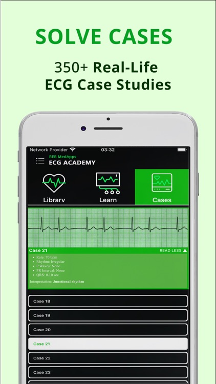 ECG Academy - Learn EKG Skills