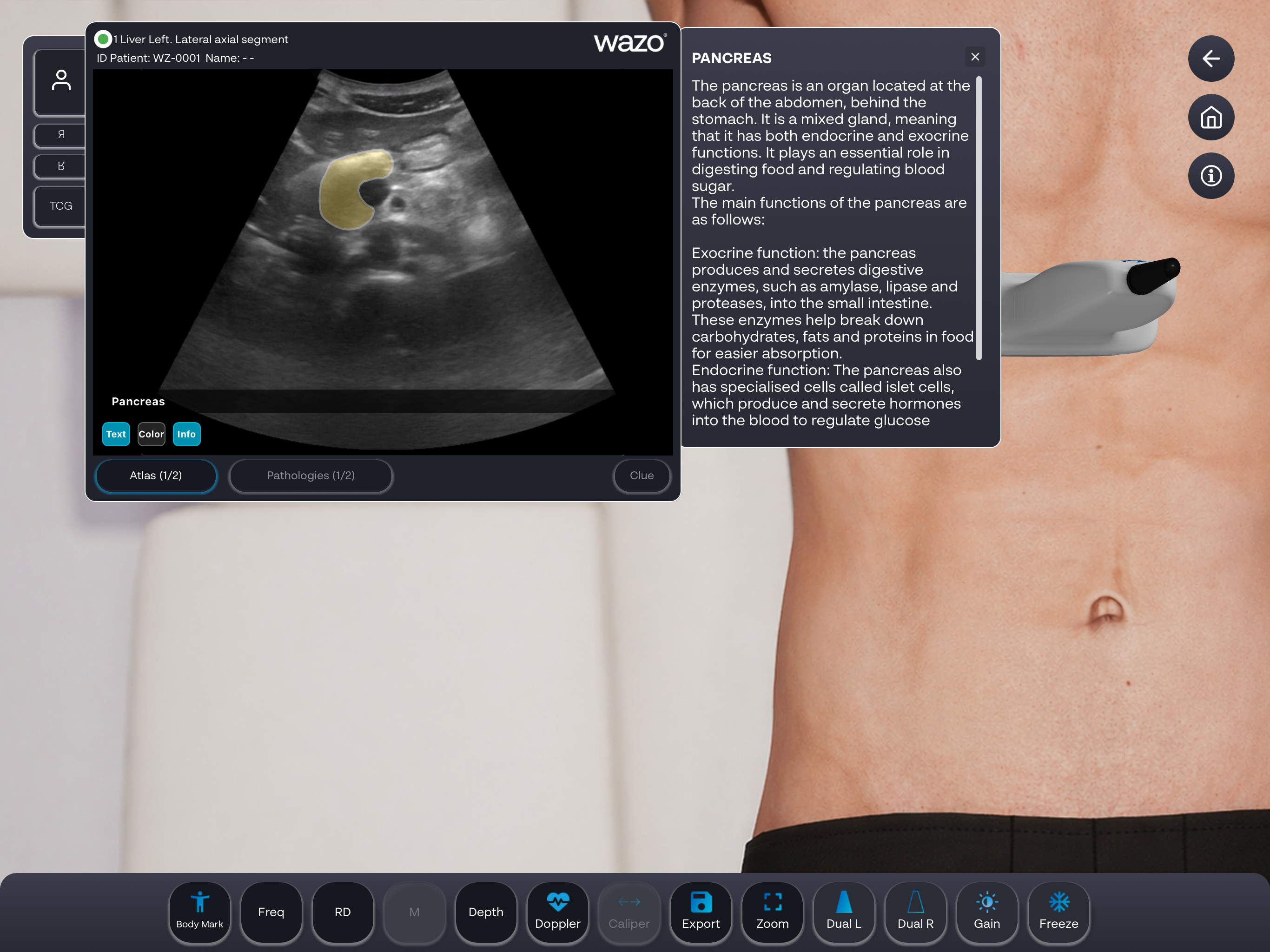 Wazo Ultrasound Simulator screenshot 14