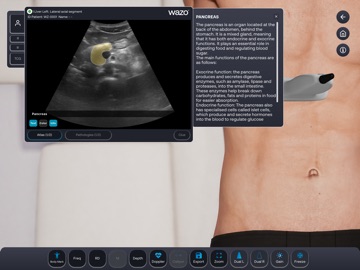 Wazo Ultrasound Simulator iPad screenshot 7