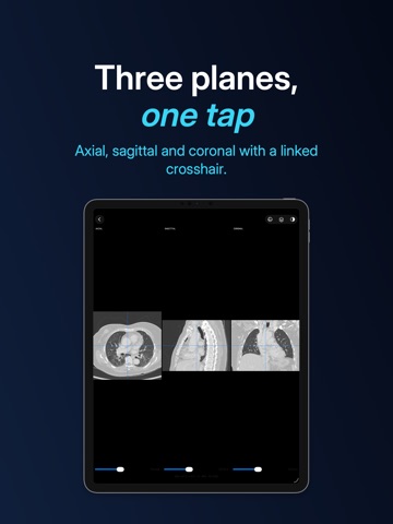 Lumen — DICOM viewer App Store preview screenshot 11