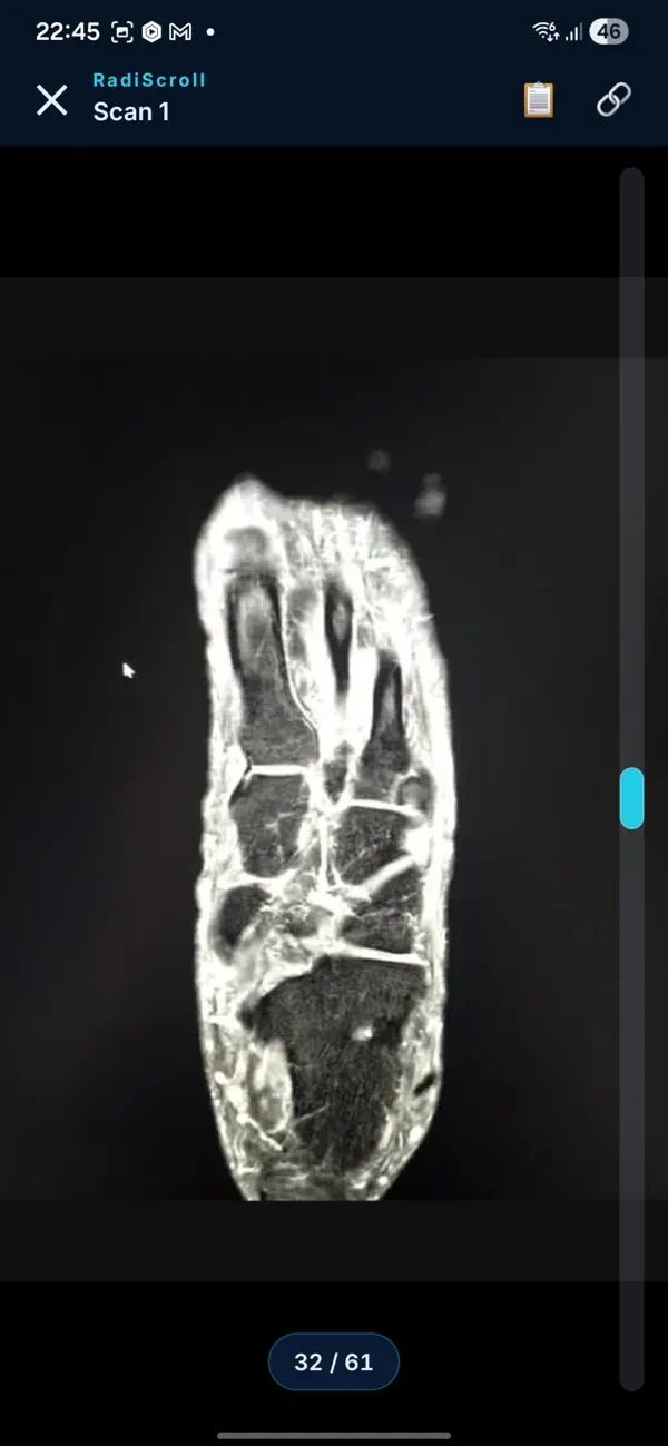 Screenshot #3 pour RadiScroll