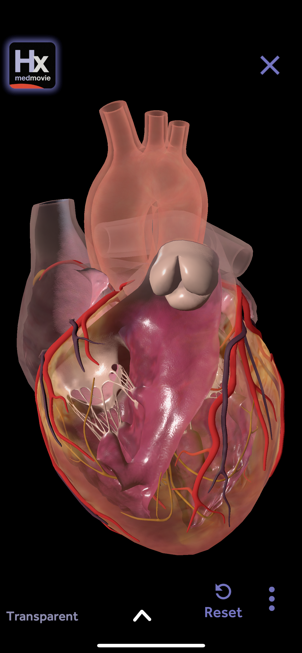 Hx Heart screenshot 5