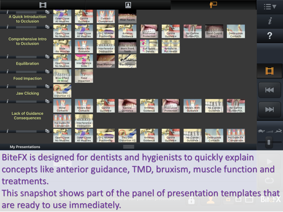 Screenshot #6 pour BiteFX