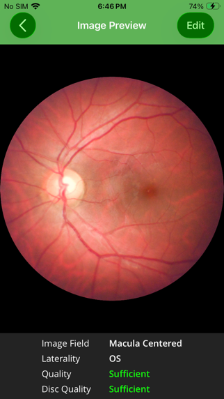 Remidio FOP iPhone screenshot 7 - Medical app