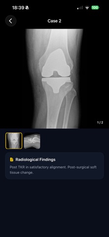 iXRKnee screenshot