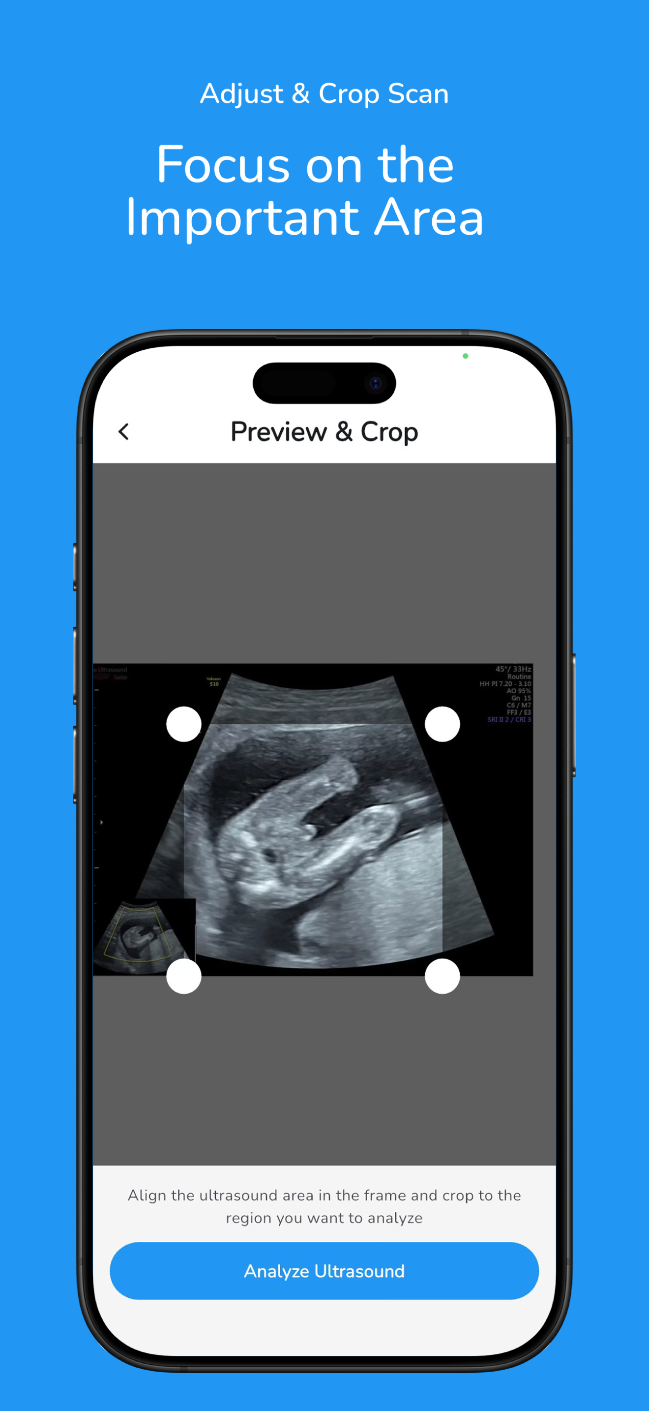 Baby Gender Scanner AI Plus screenshot 3
