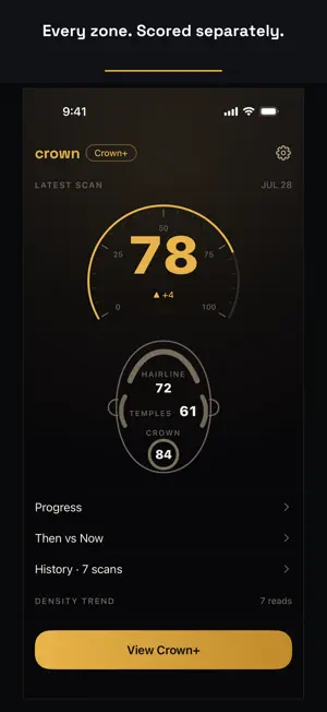 Crown: AI Hair Score screenshot 4