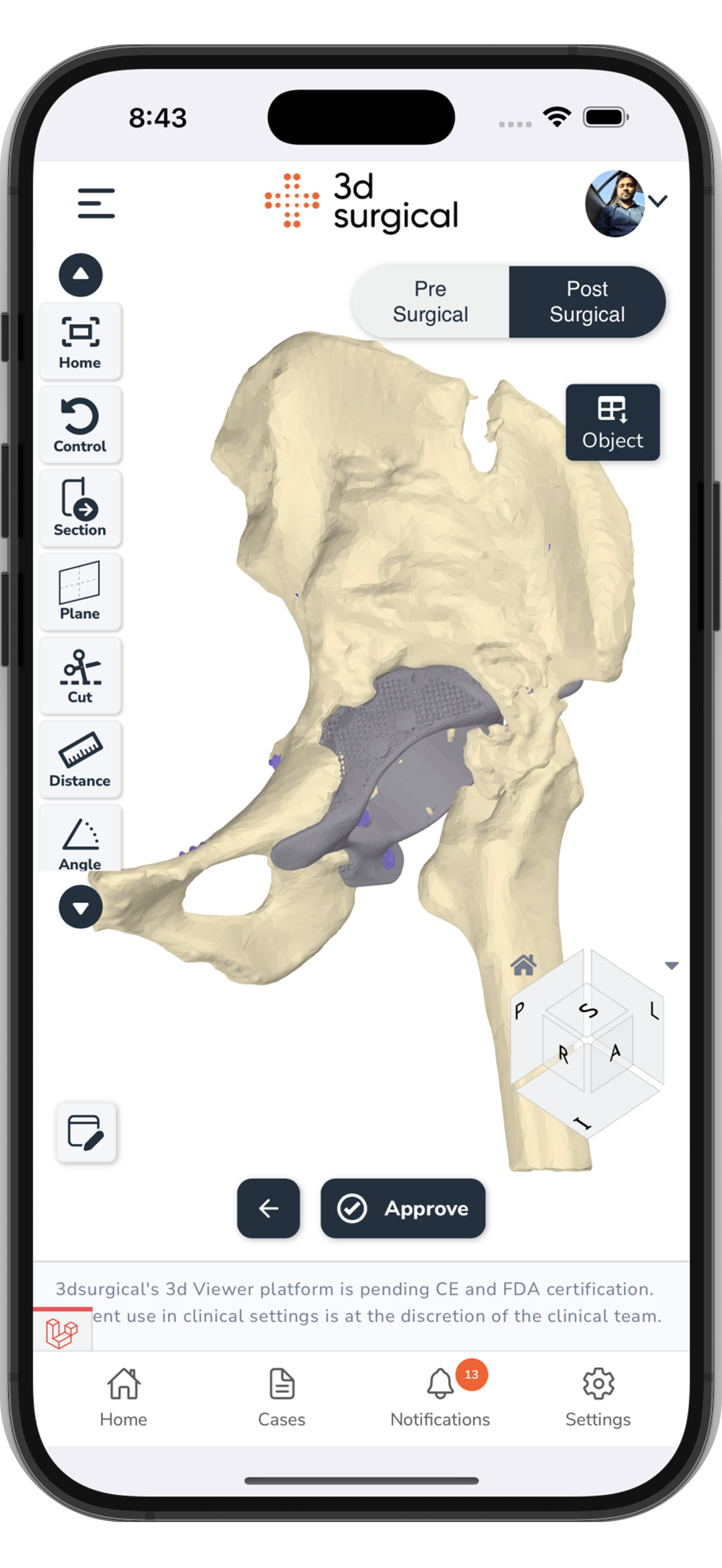 3d surgical