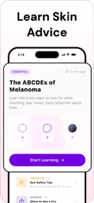 Mole Checker - SkinLog screenshot