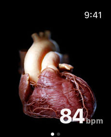 INSIGHT HEART Screenshot