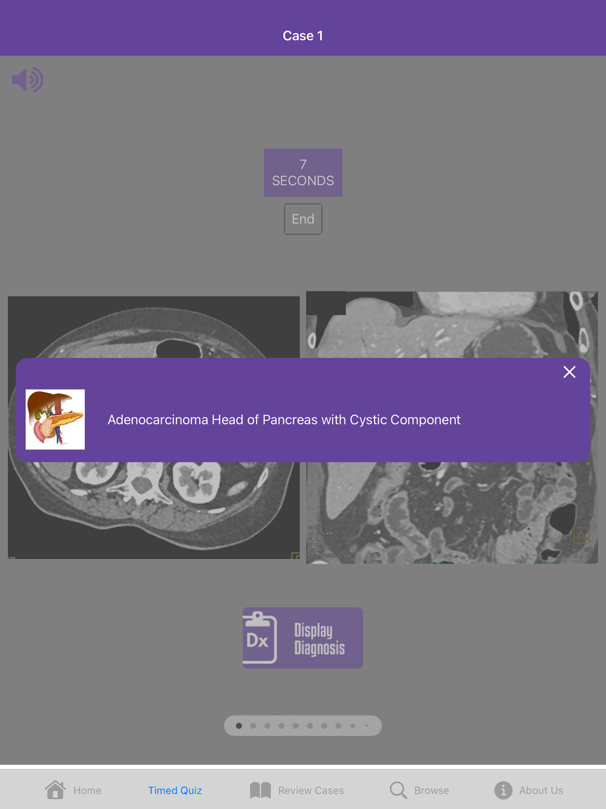 CTisus Pancreas Challenge