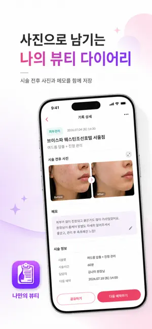 나만의 뷰티 - 뷰티시술기록 screenshot 3