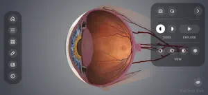 Perfect Eye screenshot 4