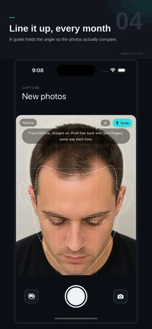 HairAgain: Hair Loss Tracker screenshot 4