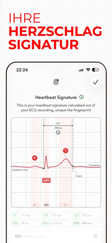 ECG+ | Your Watch ECG Reader screenshot 8 of 10