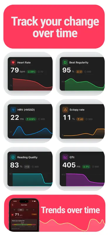 EKG Tracker+ HRV, QTc & Leser screenshot 4 of 6