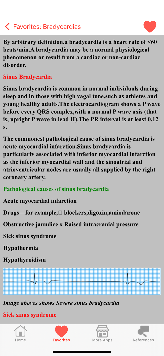 Clinical ECG Interpretation