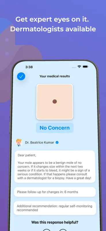 scanoma - mole check screenshot 5 of 6