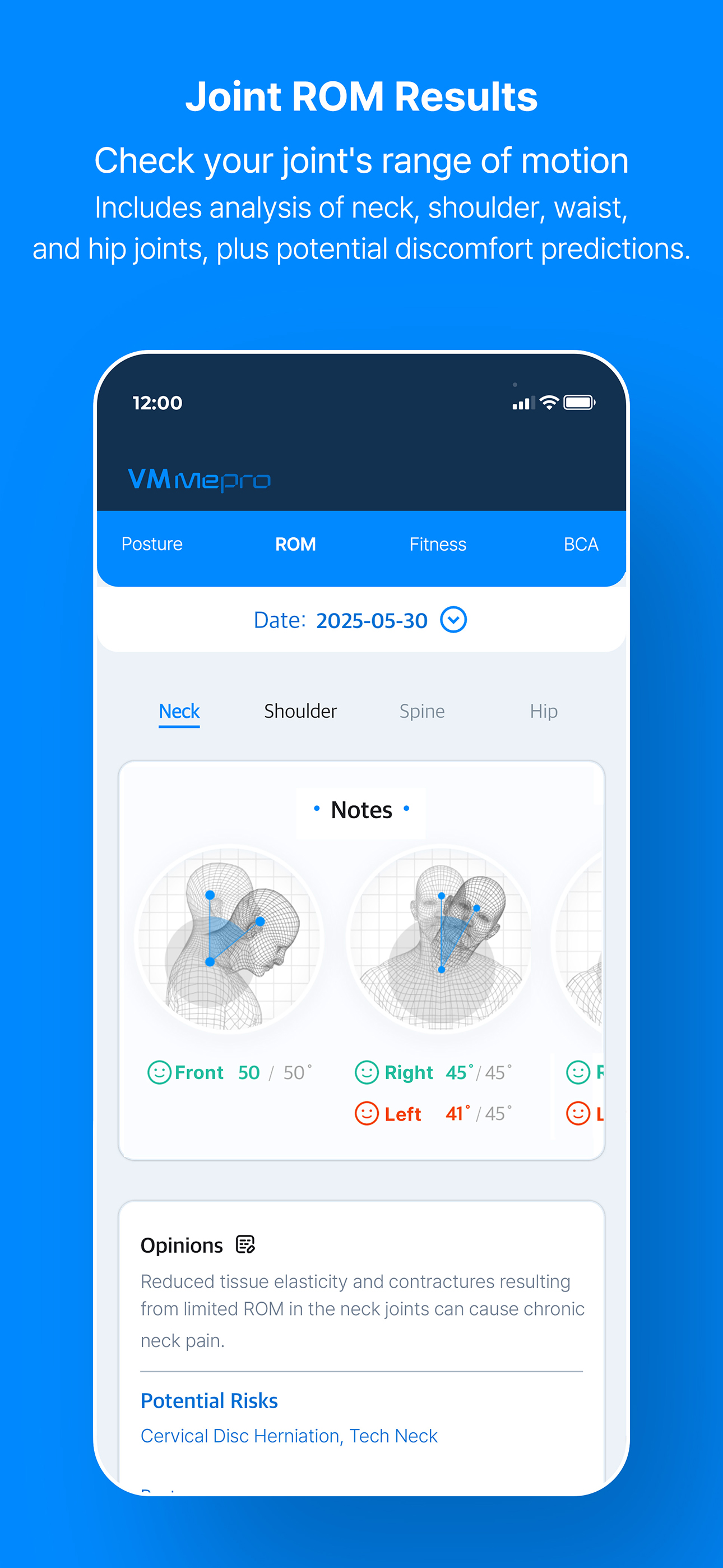 VMMe Pro