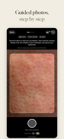 Skinovance: Skin Analyzer screenshot 2