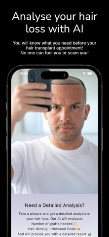 Hair Transplant AI Cost Expert screenshot