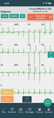 EKG Battle - Study & Compete screenshot
