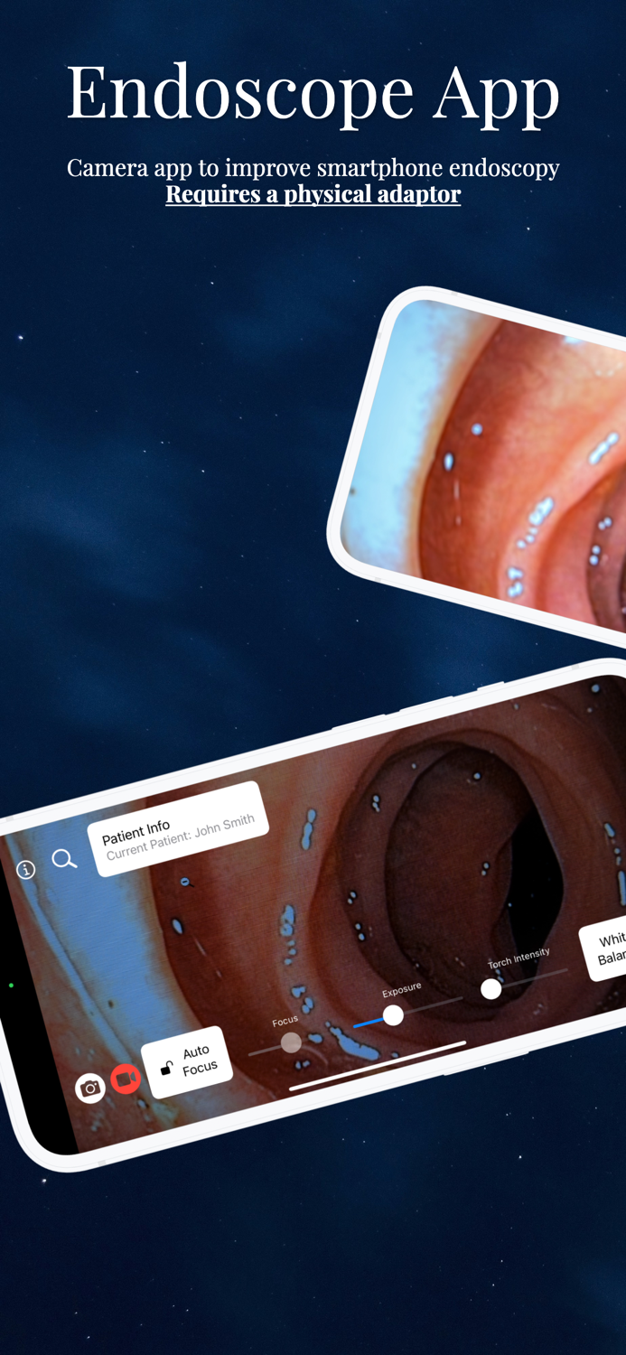 Endoscope App