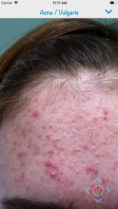 Screenshot #3 pour Dermatology (AIMapps)