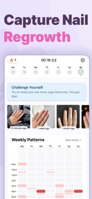 Unbite: Stop Nail Biting screenshot