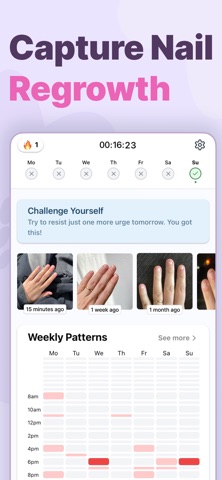 Unbite: Stop Nail Biting Screenshot 2 of 6