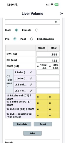 Liver Volumetry screenshot
