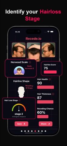 Recede.io – Predict Hairloss screenshot