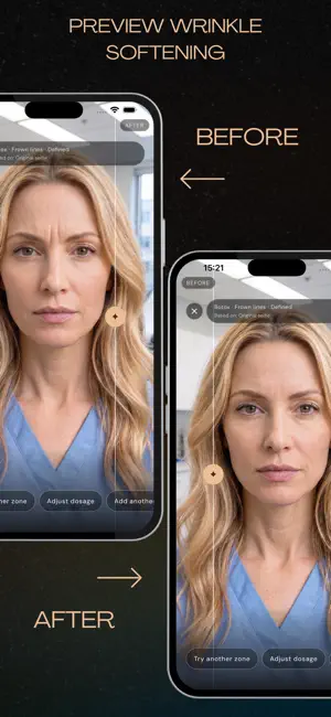 Aesthetix: Botox & Filler AI screenshot 2
