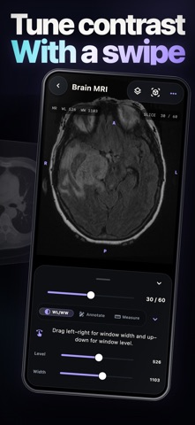 DICOM Viewer: MRI CT Studio 스크린샷 6