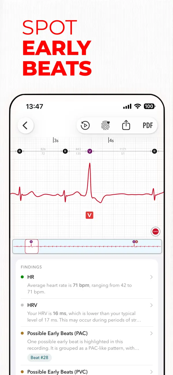 Screenshot #1 pour ECG+ | Analyse ton ECG Watch