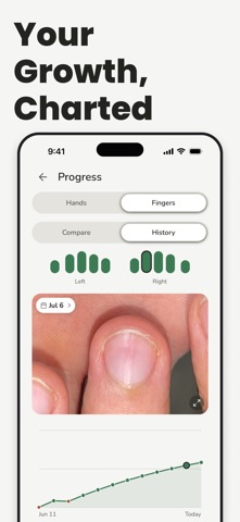 Stop Nail Biting: Nonyxa Screenshot 2 of 8