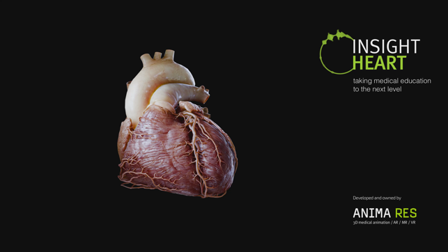 ‎INSIGHT HEART Ekran Görüntüsü