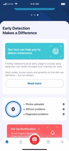 AI Dermatologist: Skin Scanner video #1 for iPhone