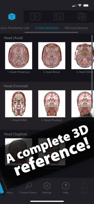 Captură de ecran Atlas de anatomie umană 2024