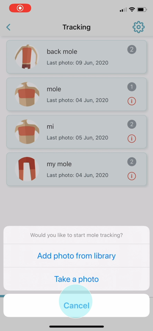 ‎MoleCare Screenshot