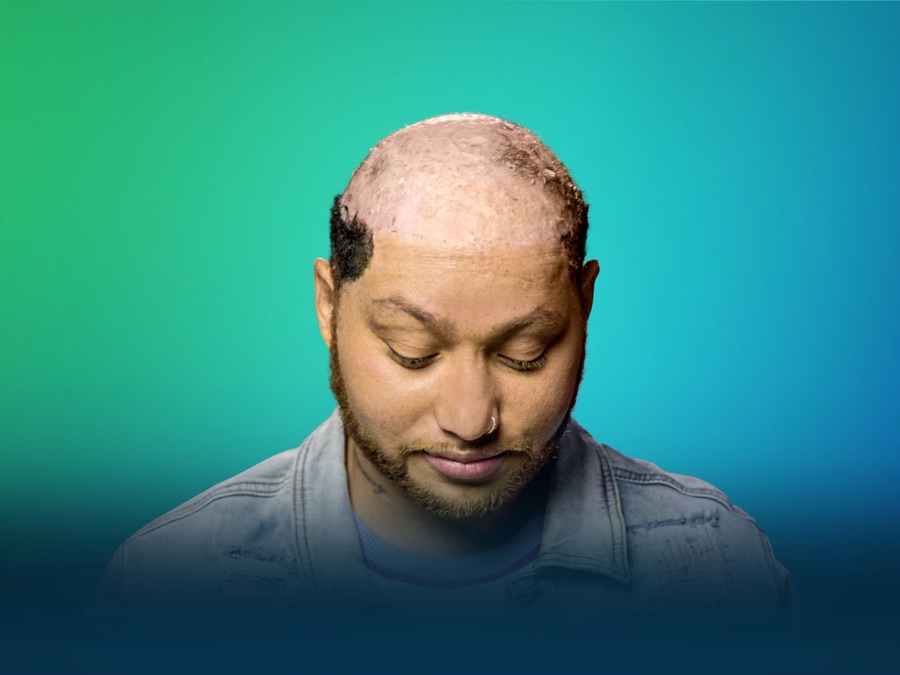 Bad Hair Day - Apple TV (CA)