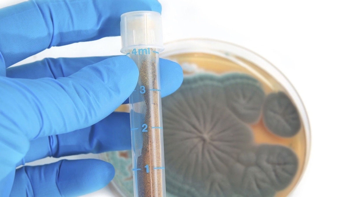 1928 - The Discovery of Penicillin – Turning Points in Modern