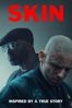 Skin - Guy Nattiv