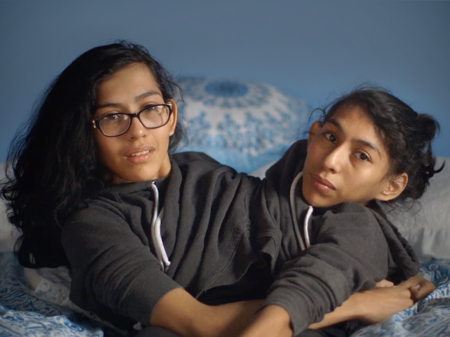 Conjoined Twins: Inseparable - Apple TV (CA)